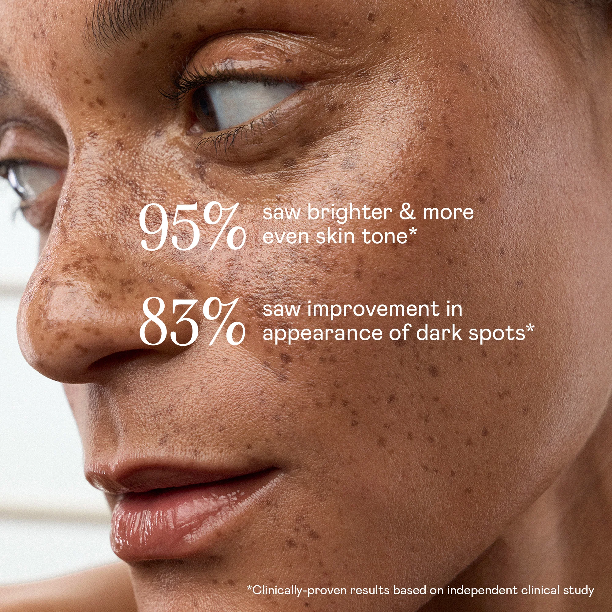 Super Vita-C Booster Serum Duo - Brightening Vitamin C Serum - Image 4
