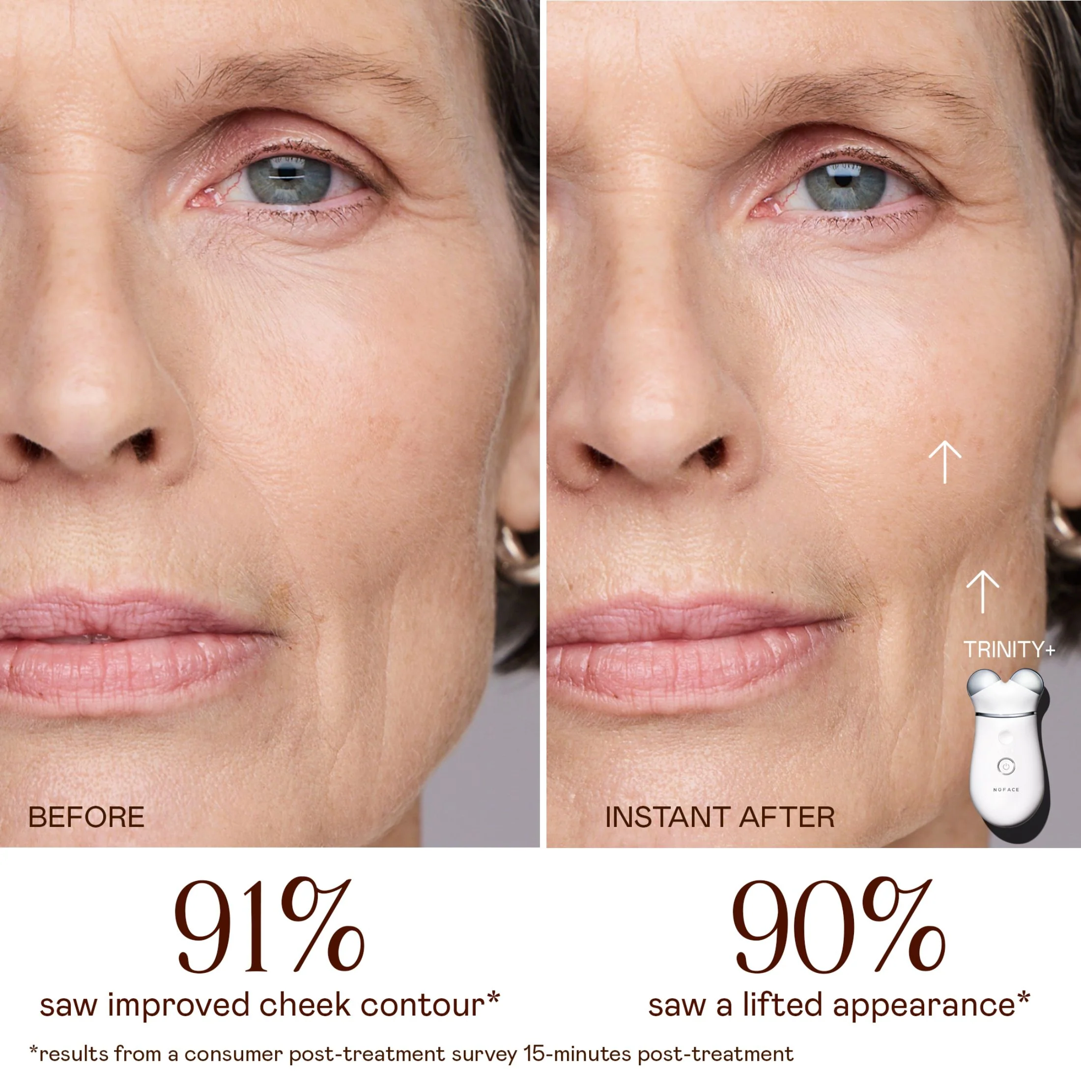 TRINITY+ Lifting & Smoothing Lip & Eye Microcurrent Attachment - Image 3